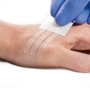 Sterile adhesive sutures - Set of 15